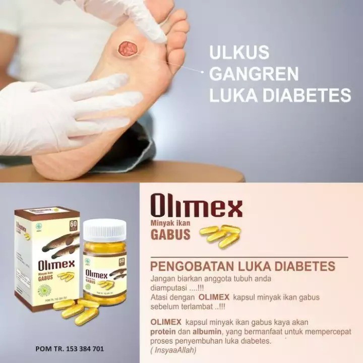 OLIMEX Minyak Albumin Kapsul Ekstrak Ikan Gabus Albumex Mempercepat Penyembukan Luka Diabetes Dan Luka Pasca Operasi Paling Ampuh