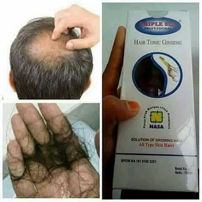 HAIR TONIC TRIPLE SIX-TRIPLE SIX HAIR TONIC GINSENG- PENUMBUH RAMBUT