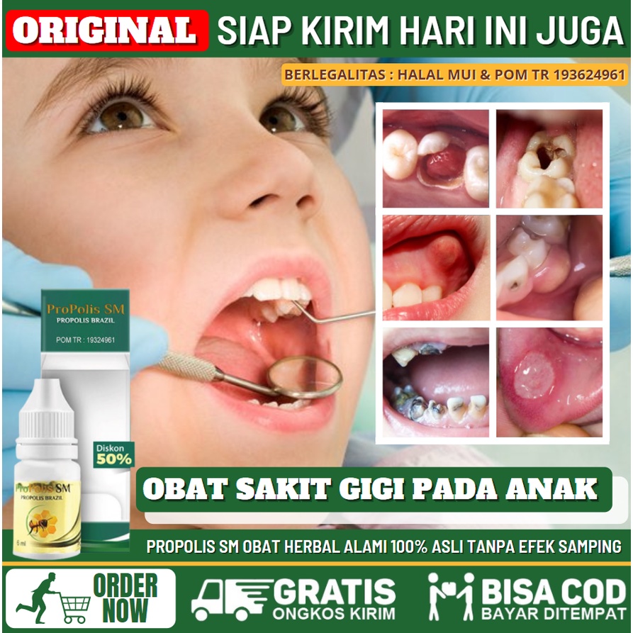 Obat Sakit Gigi Pada Anak 100% Asli Herbal Alami, Obat Tetes Sakit Gigi Berlubang, Obat Pereda Sakit