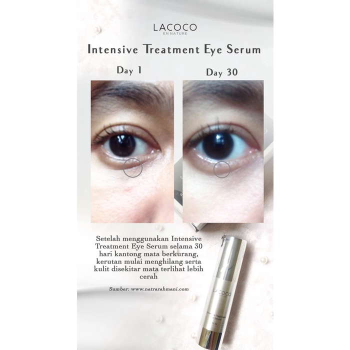 [PROMO SPESIAL] BPOM LACOCO INTENSIVE TREATMENT EYE SERUM 15ml - KRIM CREAM MATA - SERUM MATA PANDA 100% ORIGINAL