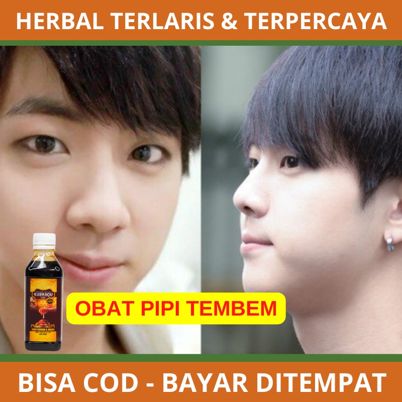 Obat Pipi Tembem, Pipi Chubby, Gemuk Pria, Penggemuk Badan, Penambah Nafsu Makan, Madu Vitamin Anak 