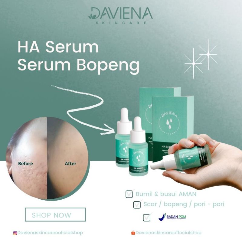 Jual [ READY STOCK ] HA SERUM / SERUM BOPENG DAVIENA SKINCARE