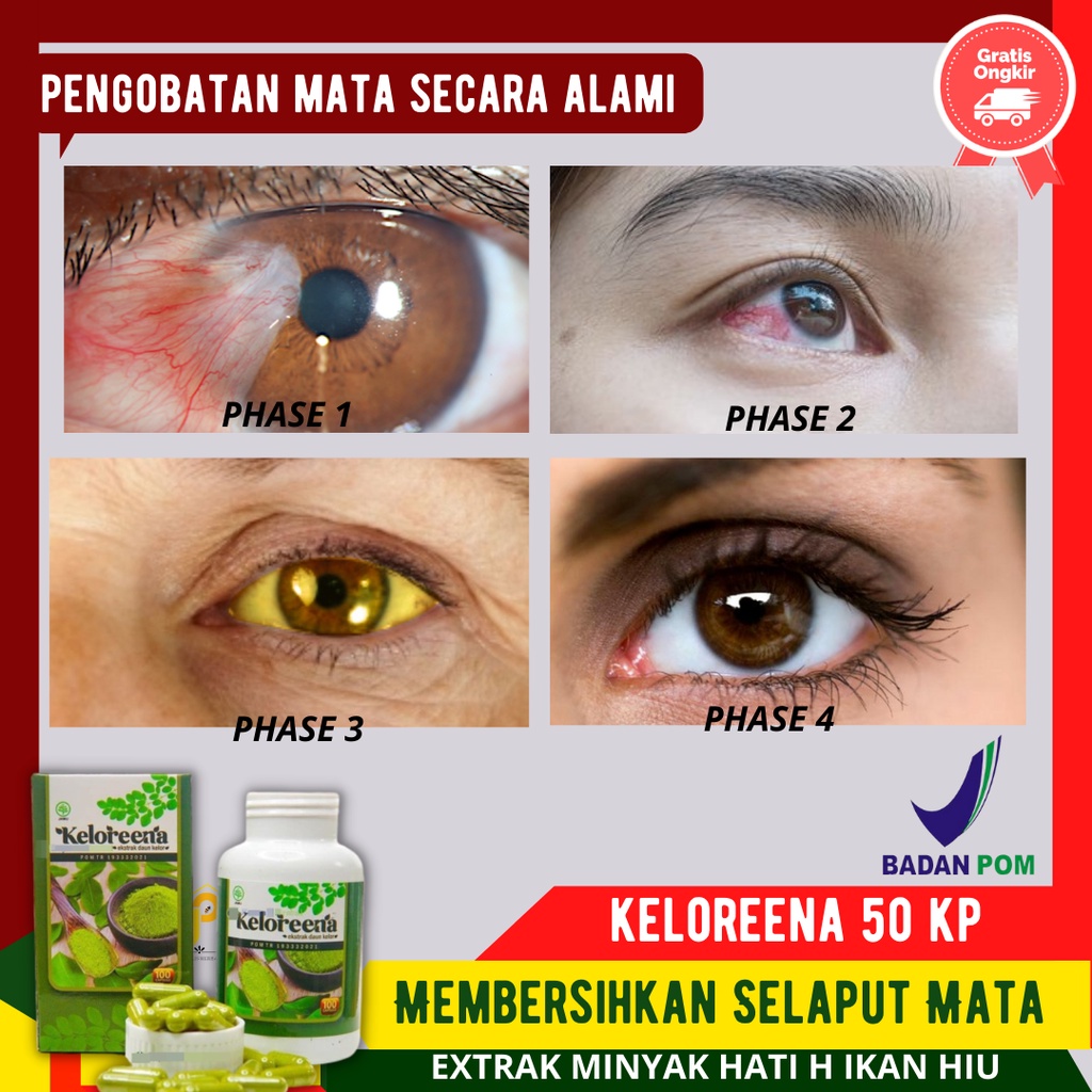 KELORENA Obat Kesehatan Mata - Pemutih Mata Kotor - bkn. Obat Tetes Mata Katarak - Memutihkan Mata K