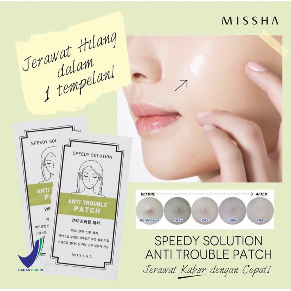 (BPOM)MISSHA SPEEDY SOLUTION ANTI TROUBLE PATCH/PATCH PENGHILANG JERAWAT/ HARGA UNTUK 1 LBR ISI 12