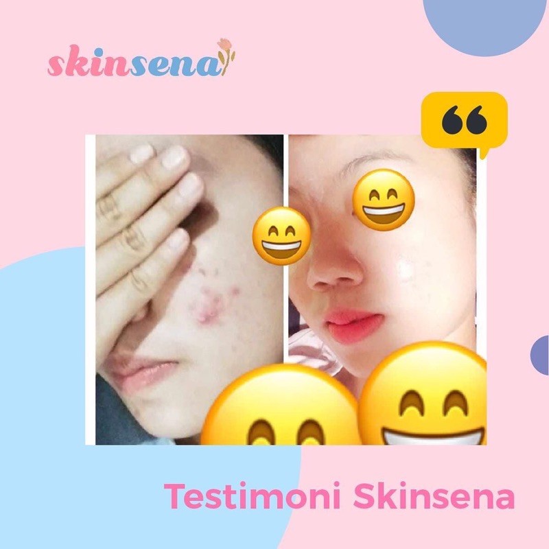 SKINSENA SKINCARE FACE GLOWING, ACNE SERIES, PAKET SKINCARE BPOM