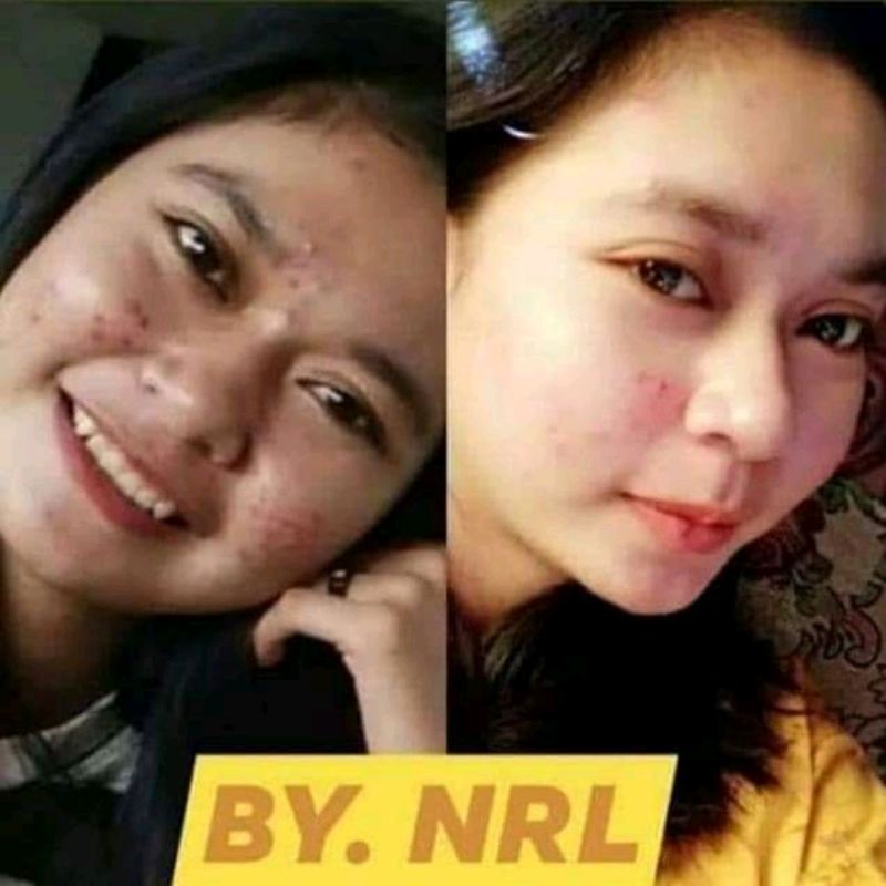 nrl kosmetik