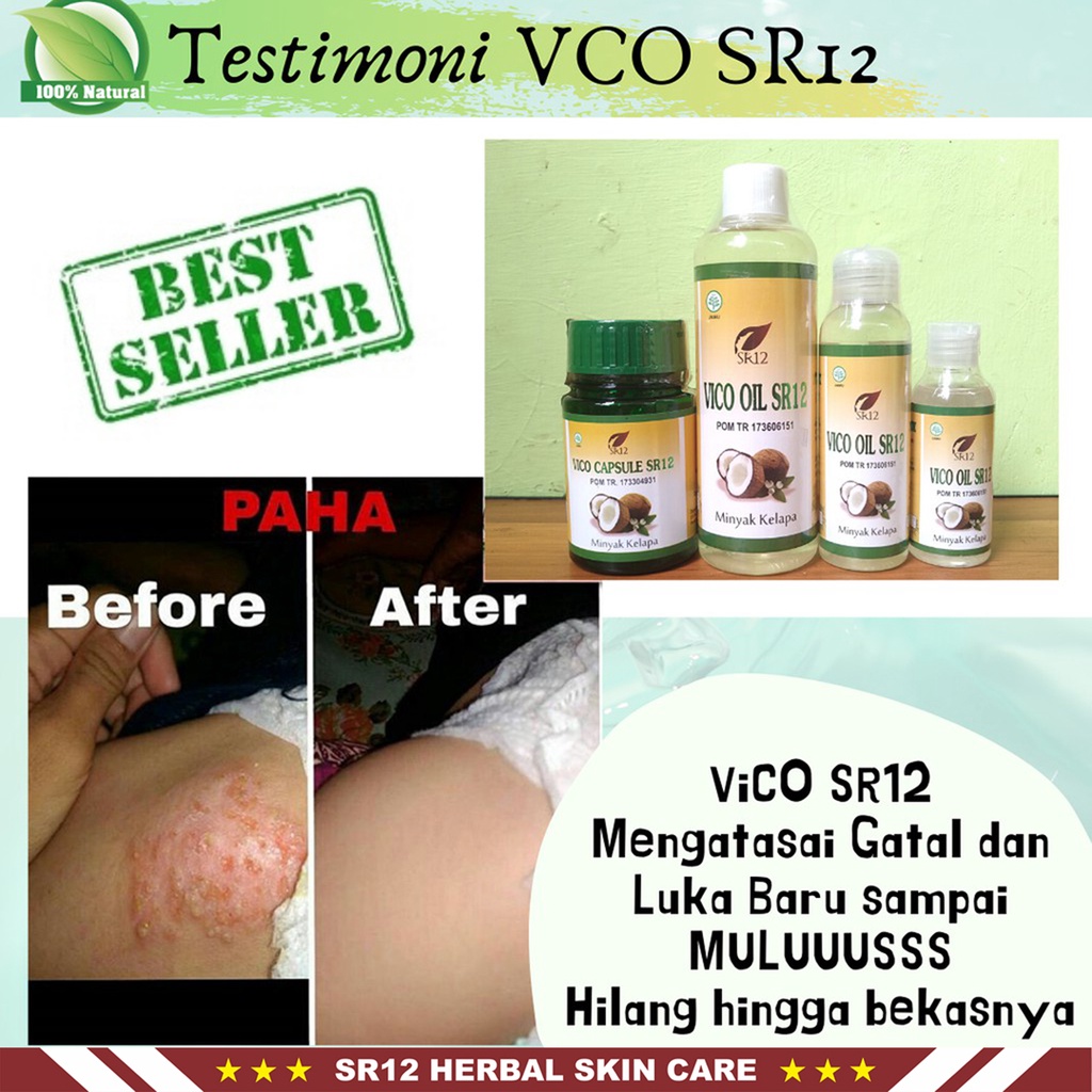 Minyak VCO SR12 | VCO Oil SR12 Herbal Netto 250ml | Memperkuat Imun Tubuh | Menjaga Kesehatan