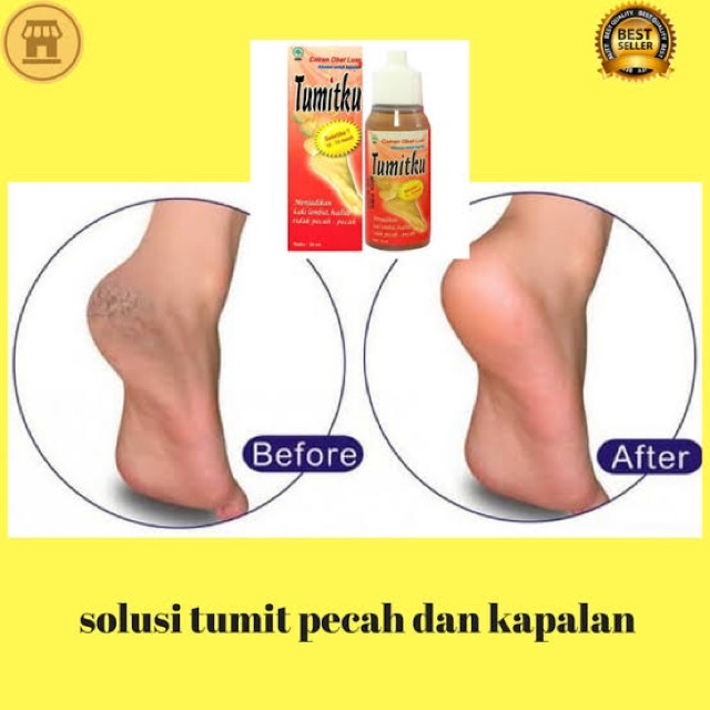 ✿ELYSABETHME✿ Tumitku penghalus kaki anti kapalan tumit pecah kering kusam mata ikan