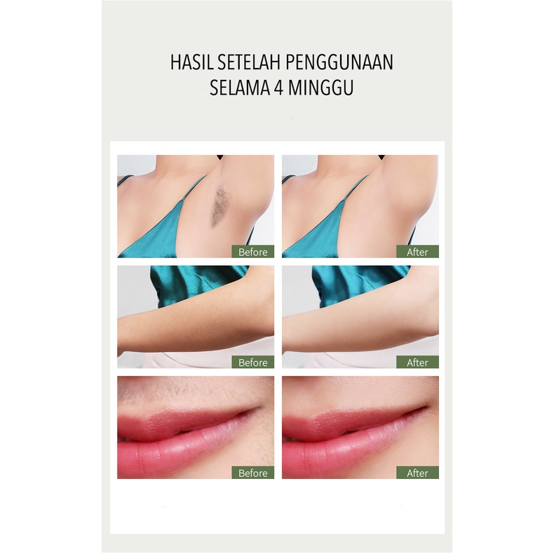 ALAT IPL LASER HAIR REMOVAL PERONTOK BULU PERMANEN ALAT PENGHILANG BULU RAMBUT TANPA SAKIT