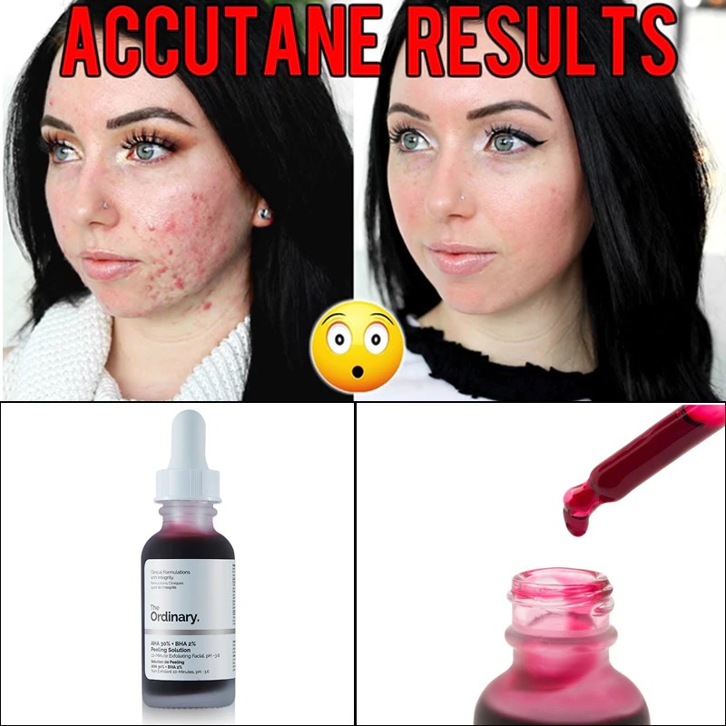 ordinary exfoliating serum