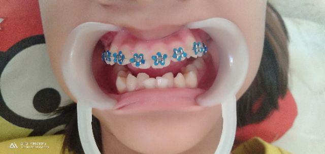 Bracket Amplop / Bracket Behel