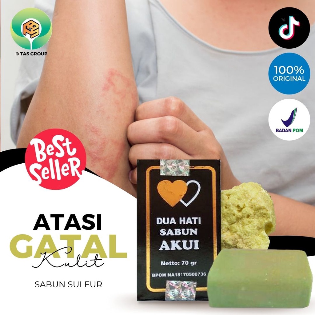 Sabun Panu Paling Ampuh Sabun Belerang Untuk Panu Sabun Penghilang Panu Sabun Penghilang Bekas Luka 