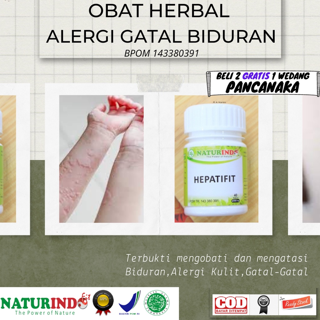 Obat Biduran Gatal Gatal Alergi Kulit Ampuh Gatel Gatel Biduren Alergi Dingin Hepatifit Naturindo