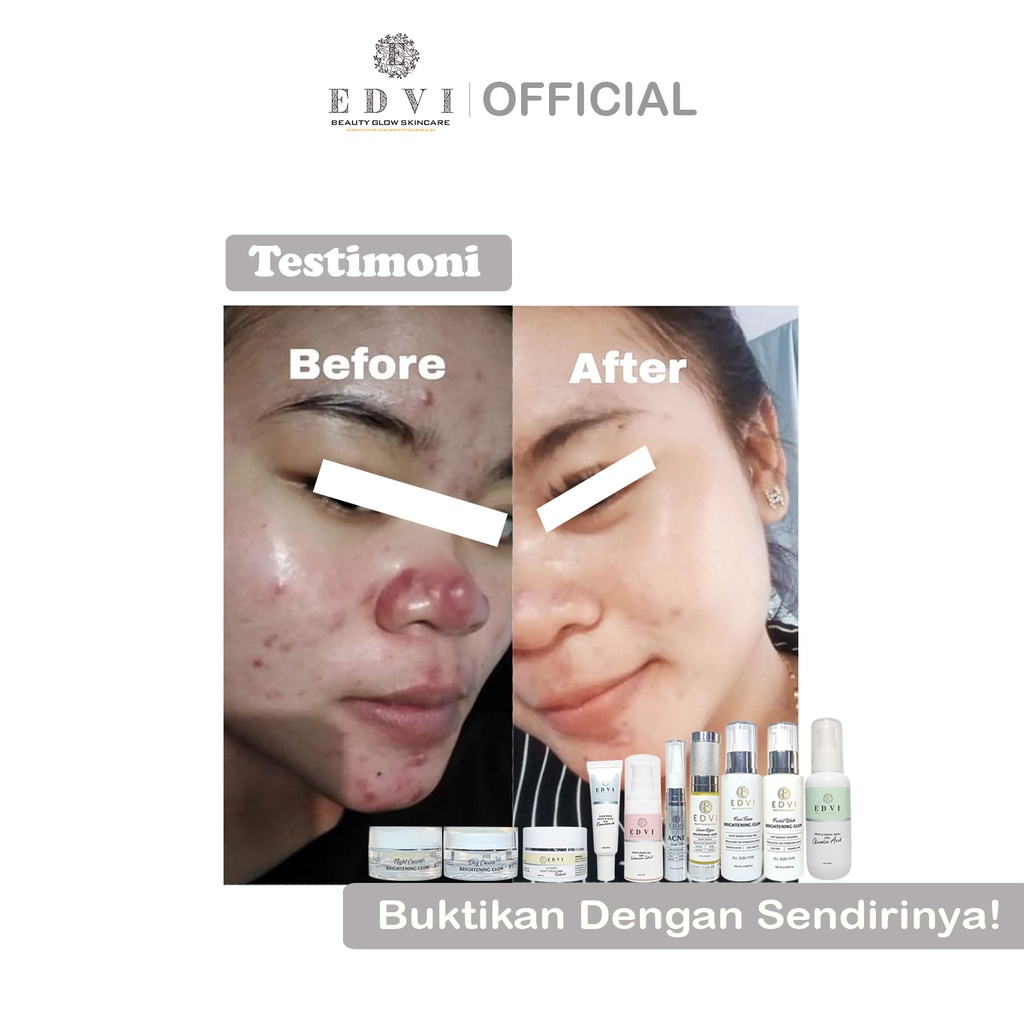 Rangkaian EDVI Beauty Glow Skincare | Paket Ultimate Series |