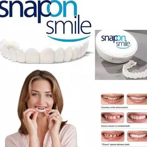Snap 'n Smile Gigi Palsu / Snap On Smile 100% ORIGINAL Authentic