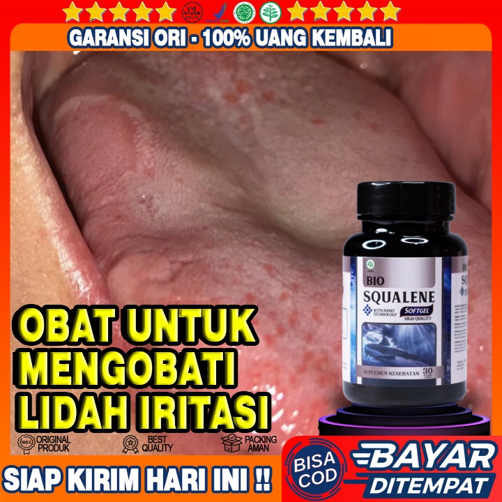 Obat Lidah Iritasi - Obat Lidah Lecet - Obat Lidah Kebas - Obat Lidah Mati Rasa - Obat Lidah Berjamu