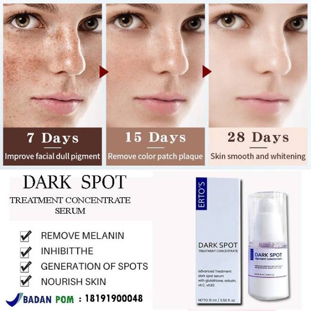 [ORI] Serum Pencerah Wajah Ampuh Menghilangkan Flek Dark Spot Treatment Concentrate dalam 2 Minggu