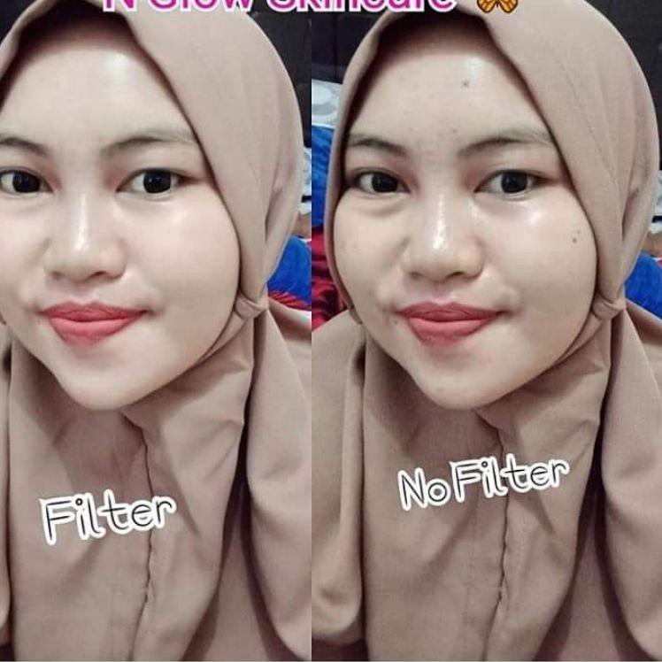 R3stok lagi skincare N'glow |O|F00|7 !!!!
