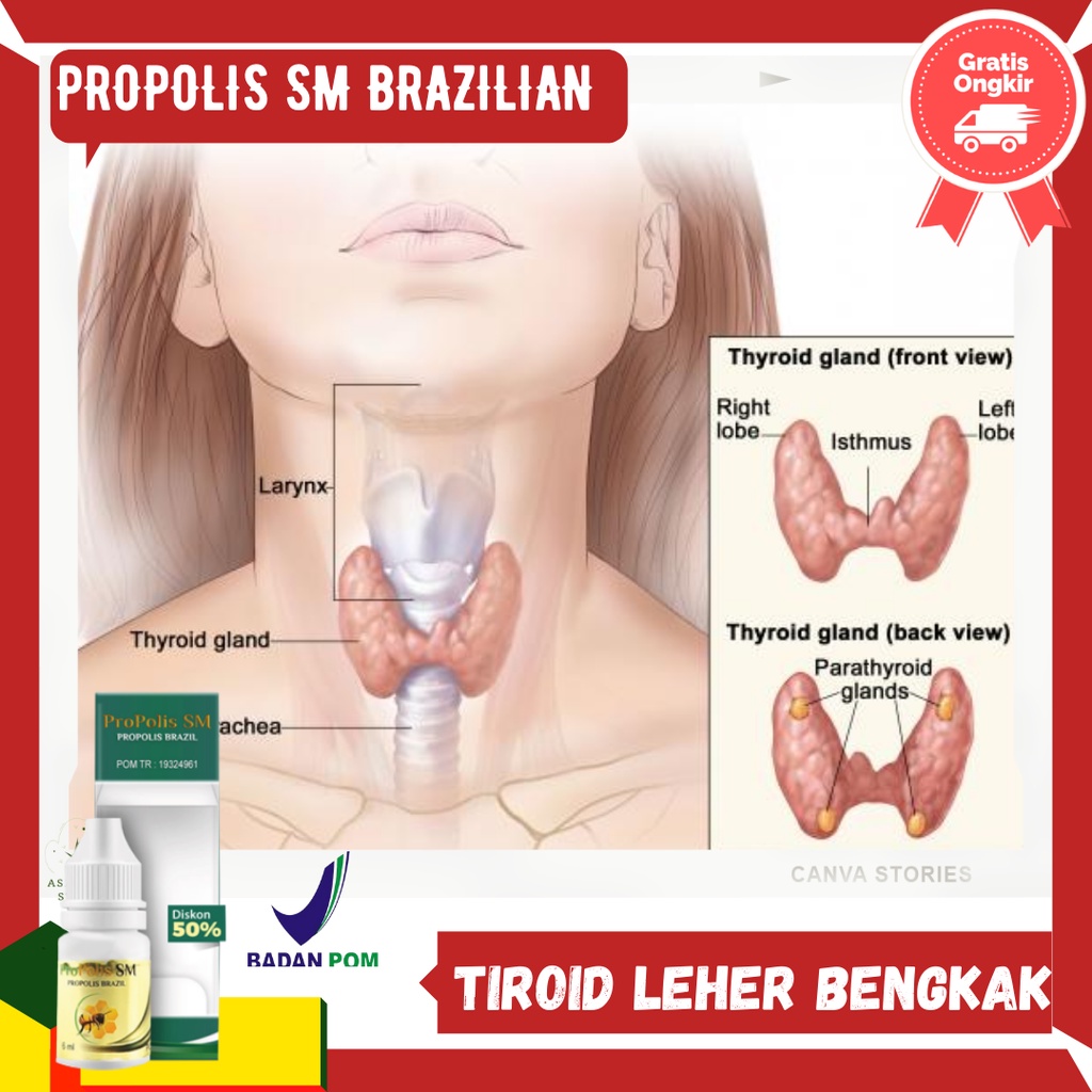 Propolis SM Obat Alami Kelenjar Leher Bengkak obat tiroid cina, Pengempes Leher bengkak,Tiroid anak