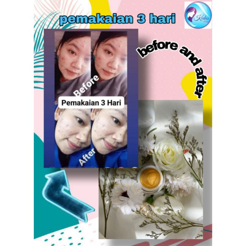 kedas beauty sabun, Gold jelly kedas beauty, body serum kedas beauty,body scrub kedas beauty-1