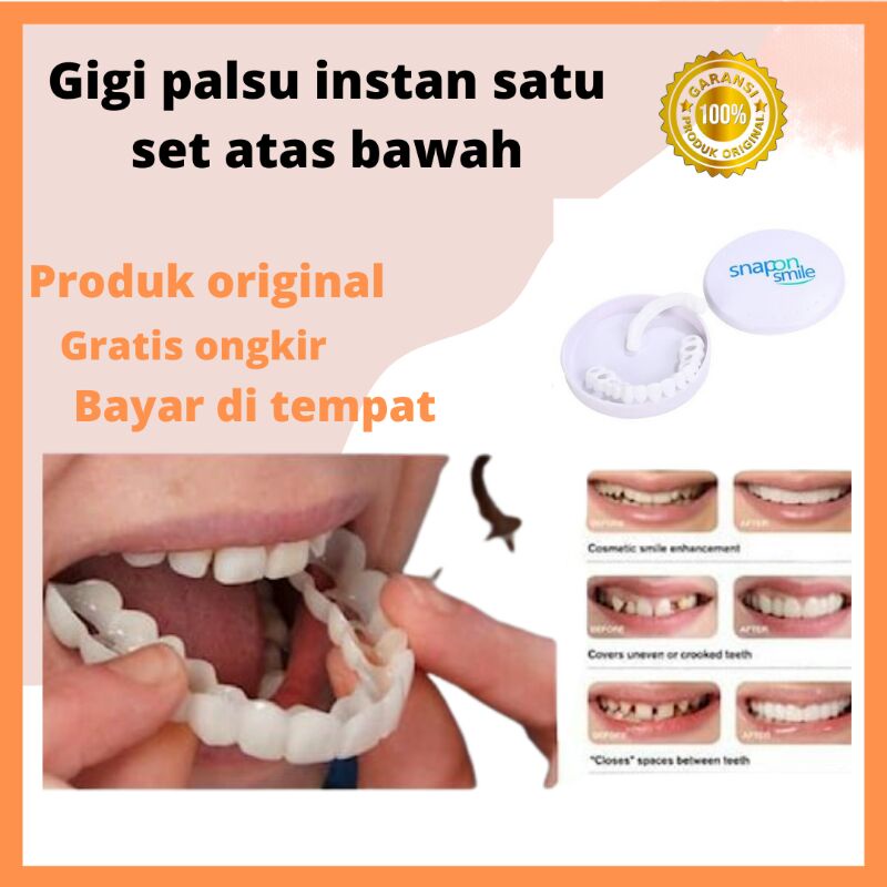 Gigi Palsu Instan Atas Bawah Snap On Smile 100% Original/Veneer Vener Gigi Palsu Atas Bawah