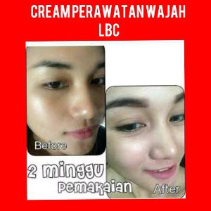 Paket Perawatan Wajah Cream Pencerah Wajah Cream Pemutih Wajah Lbc Shopee Indonesia