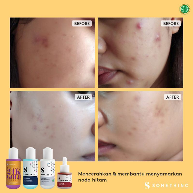 Somethinc Serum Series [Niacinamide 5%/HYAluronic/Bakuchiol/AHA BHA PHA/Salmon/Retinol 1%/24K Gold]