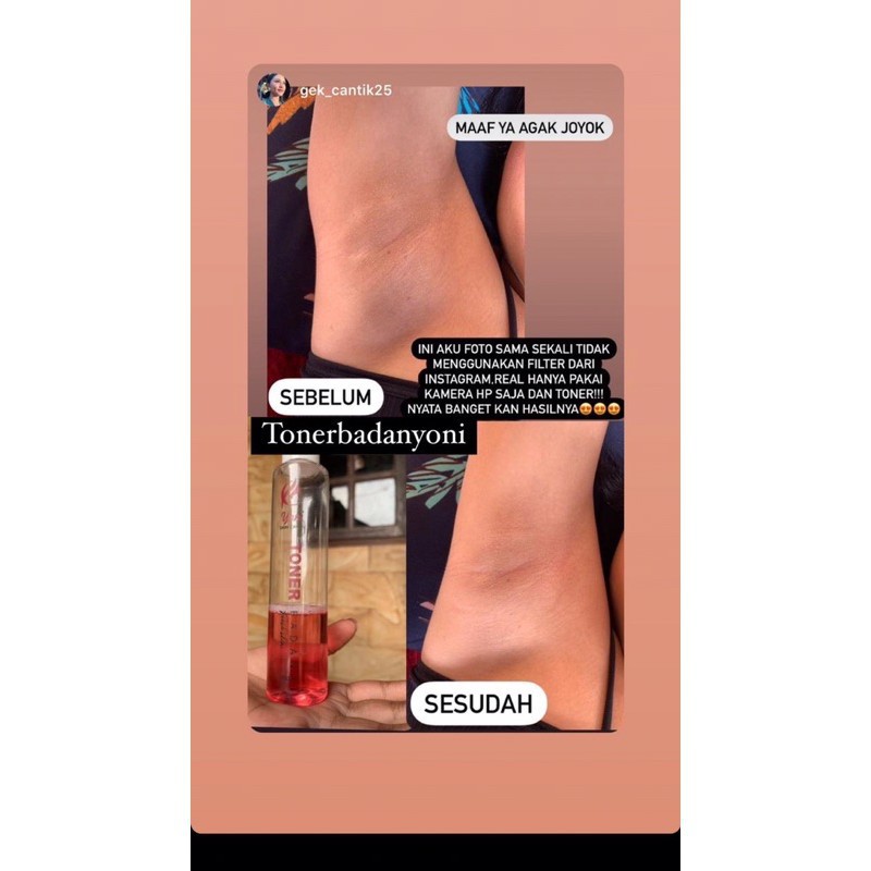 [BPOM]  YONI SKINCARE TONER BADAN PENGHILANG &amp; PEMBERSIH DAKI BADAN