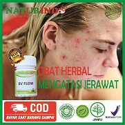 OBAT HERBAL bisul kadas kurap panu menghilangkan jerawat bekas jerawat penghilang jerawat bisulan