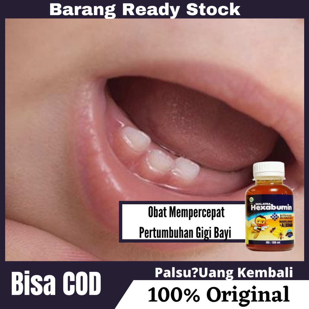 HEXABUMIN Untuk Mempercepat Pertumbuhan Gigi Bayi , Pertumbuhan Gigi Anak , Nyeri Saat Tumbuh Gigi