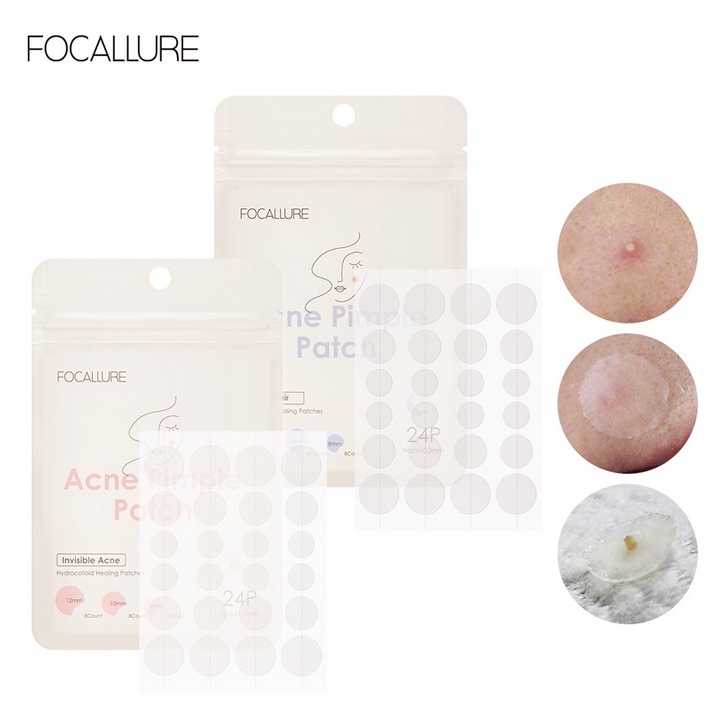 FOCALLURE (day / night) acne patch obat jerawat sticker mengatasi jerawat batu biji beruntusan bruntusan murah bpom pagi malam tipis tidak tebal