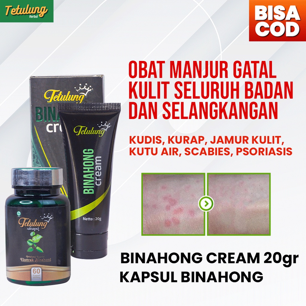 Obat Gatal Kulit Paling Ampuh Obat Gatal Alami &amp; Menyebar - Paket Salep Binahong &amp; Kapsul Binahong BPOM