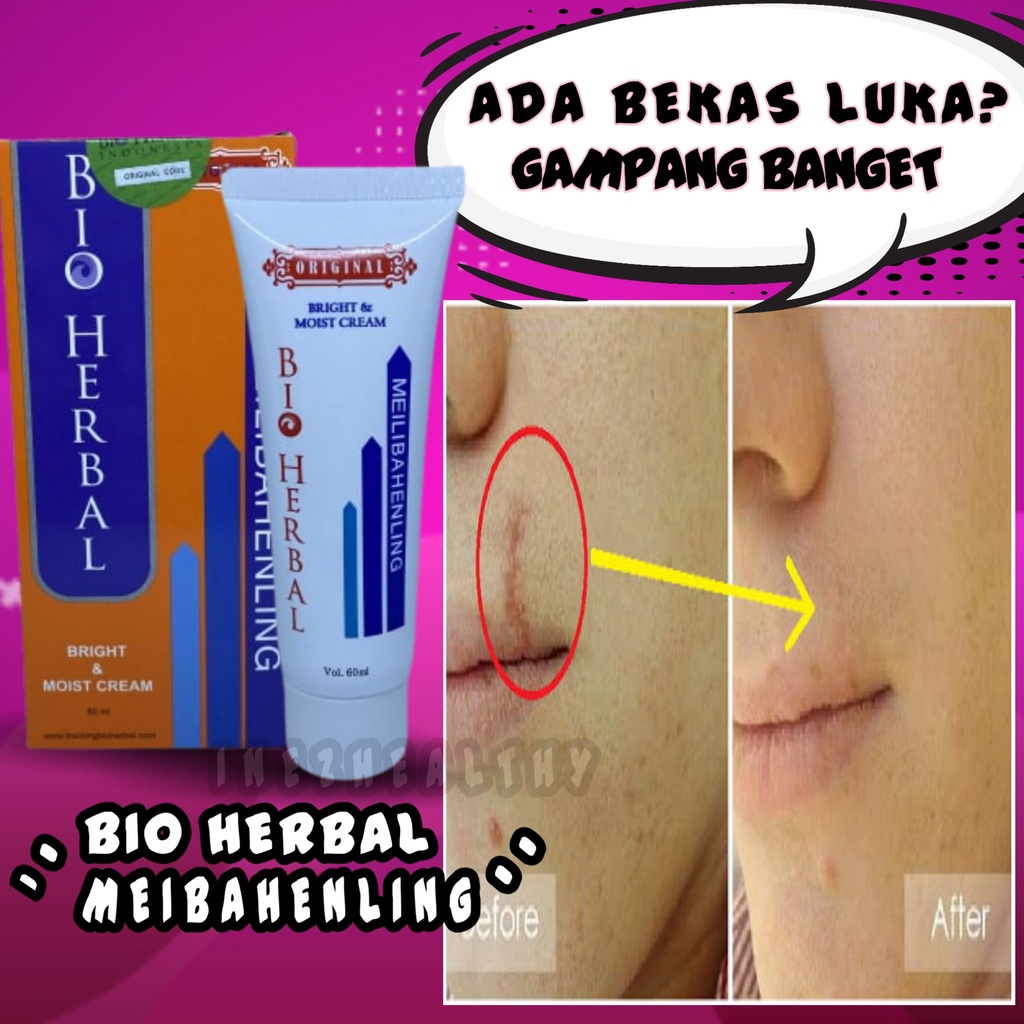 BIO HERBAL MEILIBAHENLING CREAM OBAT PENGHILANG BEKAS LUKA CREAM SALEP OBAT PEMUTIH KULIT TUBUH ORIGINAL