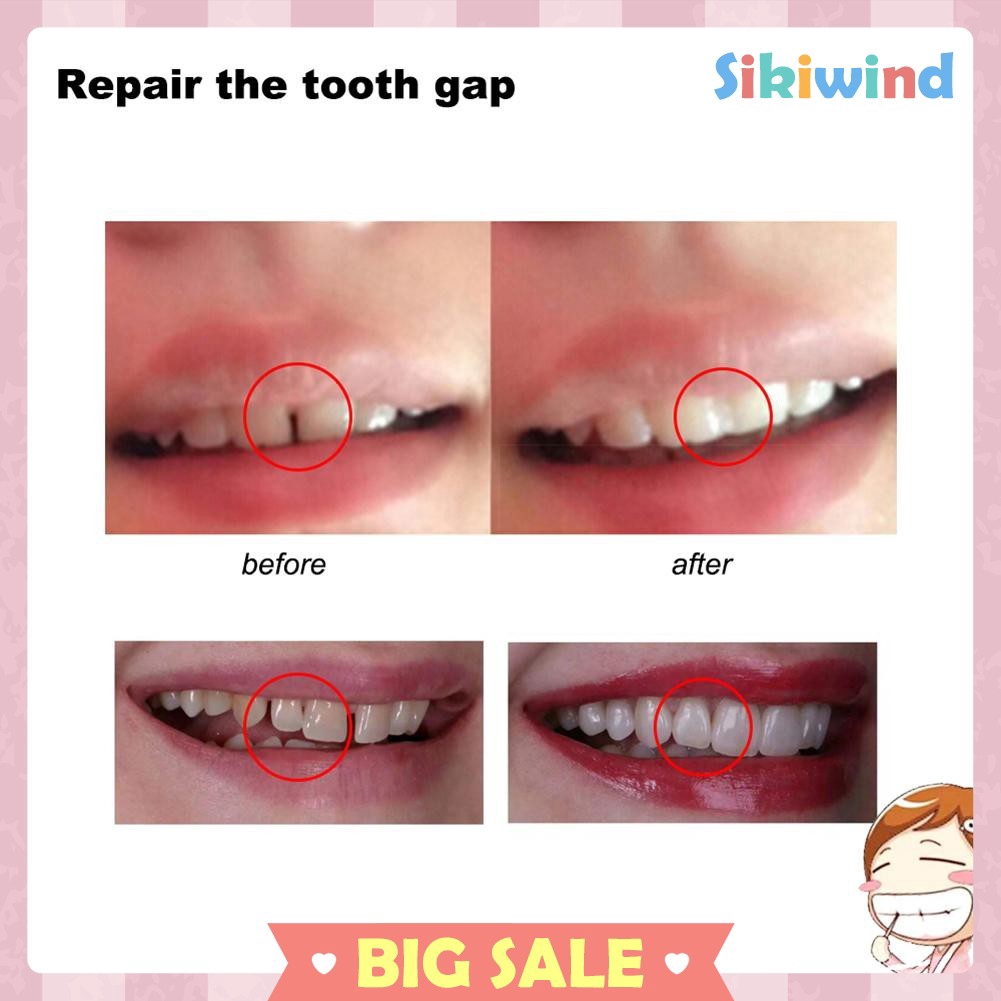 Sikiwind 10g 100g Lem Solid Untuk Memperbaiki Gigi Palsu