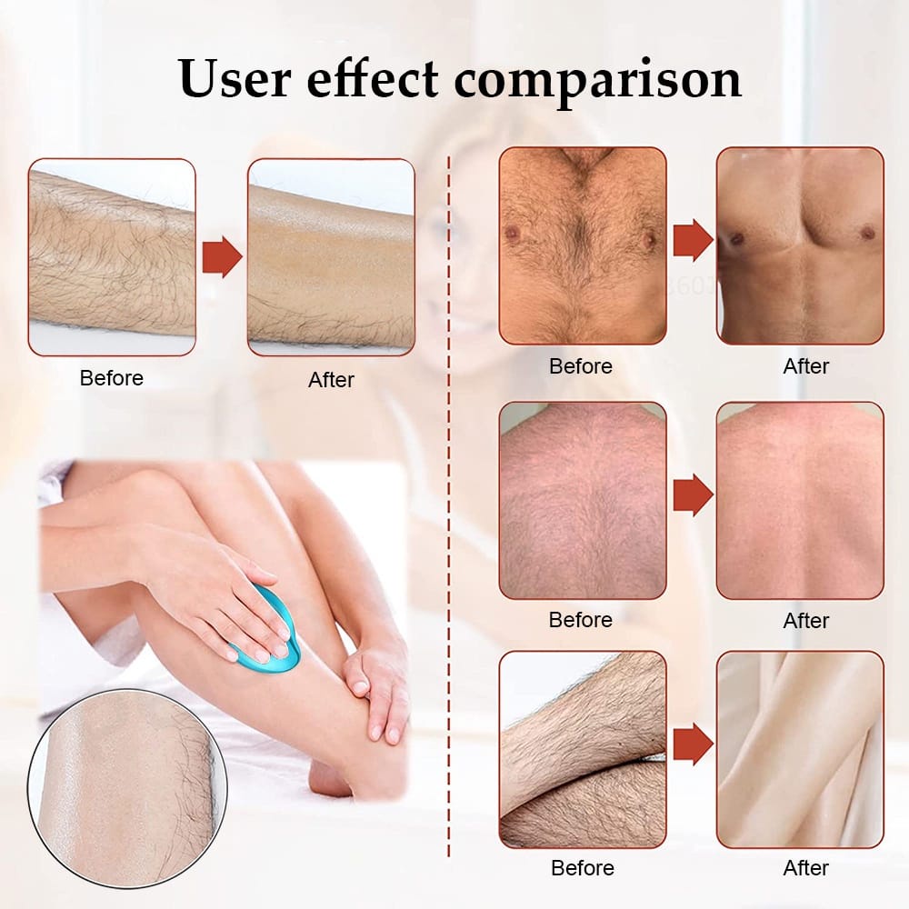 Glass Epilator Hair Removal / Pencukur Bulu Tubuh Aman Tidak Sakit / Beauty Tools Hair Remover