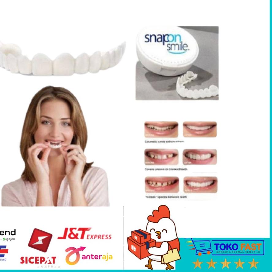Trendy Sepasang Perfect smile snap on smile / gigi palsu snap on instan .,