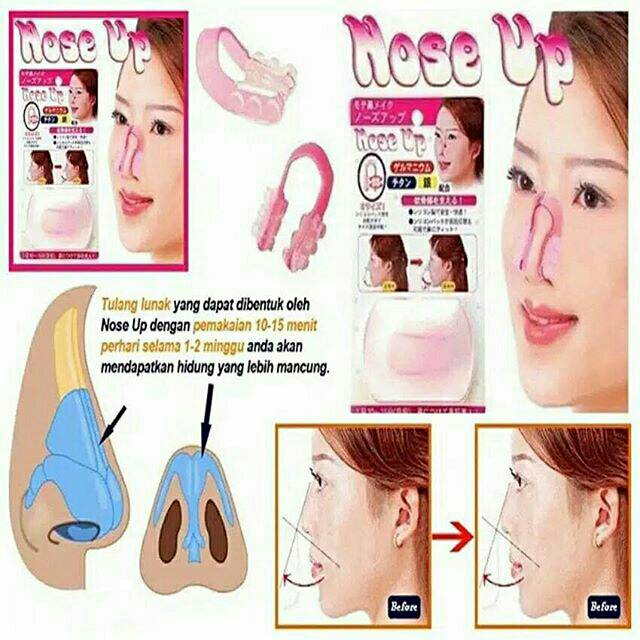 NOSE UP / PEMANCUNG HIDUNG / ALAT PEMANCUNG / NOSE UP CLIPPER