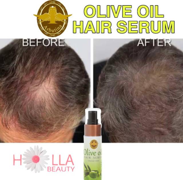 ARBUTINA OLIVE OIL HAIR GROWTH &amp; HAIR LOSS SERUM / PENUMBUH RAMBUT / SERUM RAMBUT /  HAIR TONIC