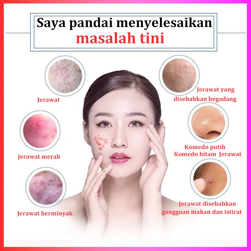 cream jerawat krim jerawat alat jerawat cream untuk jerawat cream jerawat ampuh krim malam jerawat Anti Jerawat penghilang jerawat salep jerawat serum penghilang jerawat pembersih jerawat acnes gel jerawat