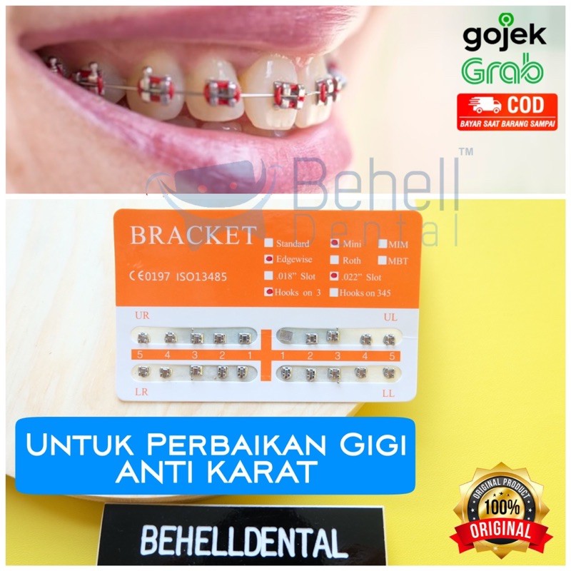 ANTI KARAT Bracket Behel Fancy Orange Metal Mini Edgewise 0.22 Dental Permanen Orens Oranye ORI