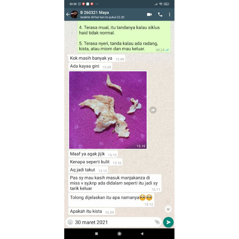 Manjakani Kanza 100% Asli / Obat Keputihan Gatal Bau Paling Ampuh BPOM / Pelancar Haid / Obat Kista Miom Ovarium Bartholin Tanpa Operasi / Obat Endometriodis PCOS Ampuh Teruji Klinis / Program Hamil Herbal Promil-7