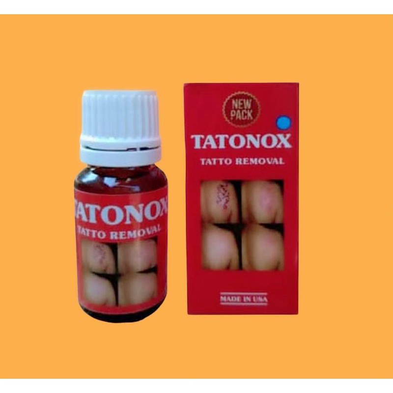 Tatonox Penghilang Tato Permanen