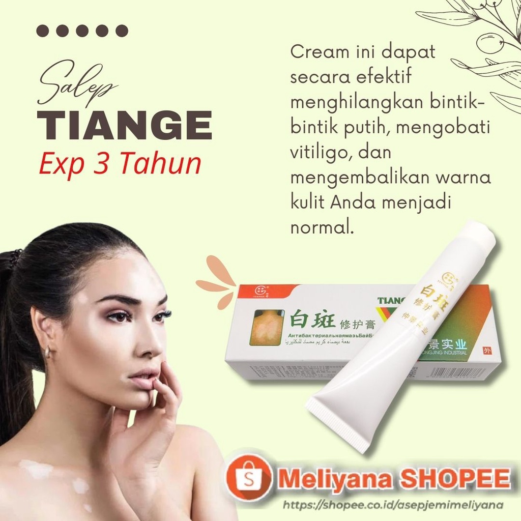 Obat Salep Krim Vitiligo Kulit Bercak Belang Putih White Spots Tiange