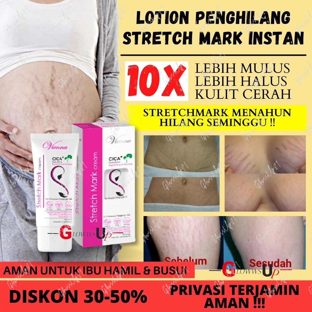 CREAM PENGHILANG STRETCH MARK VIENNA STRETCH MARK CREAM ORIGINAL BPOM - ANTI SELULIT