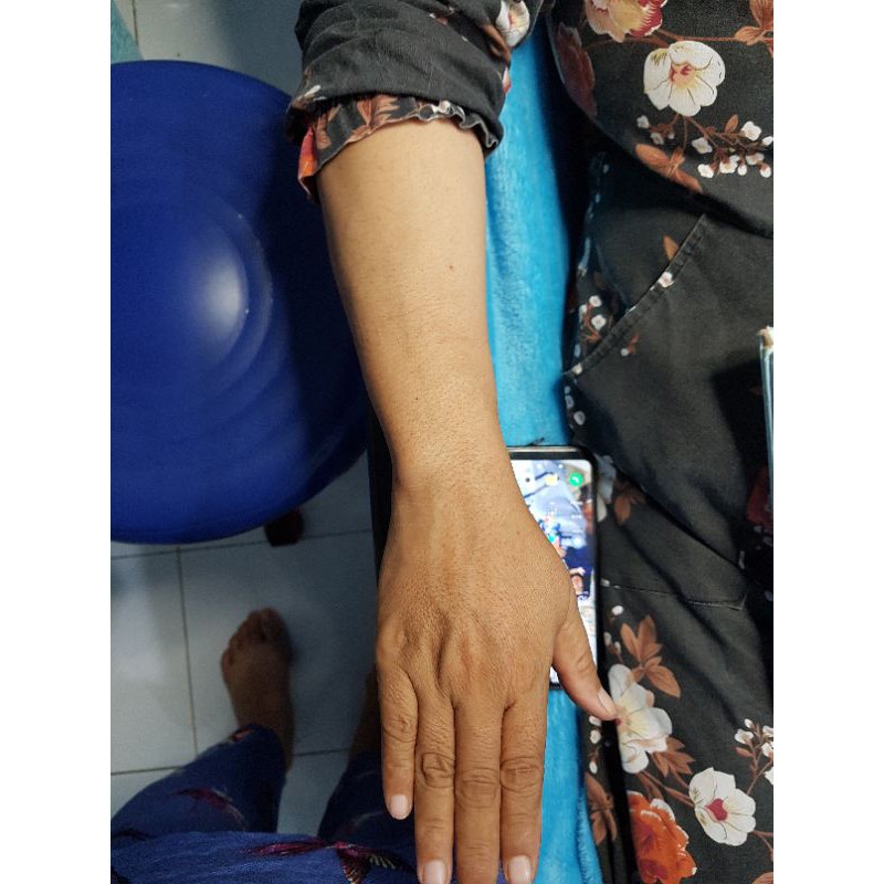 coctail infus cromosom dosis standart 1set/1x infus