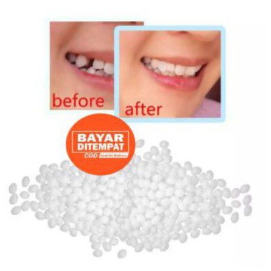 TEMPTOOTH 100 BUTIR PENAMBAL GIGI GIGI PALSU BUAT SENDIRI VENEER GIGI KELINCI