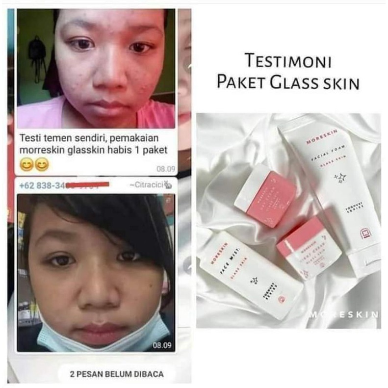 Moreskin glaskin/ glaskin Moreskin/ crem perawatan glow up Glaskin