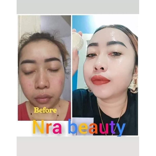 NRA BEAUTY BY INCES