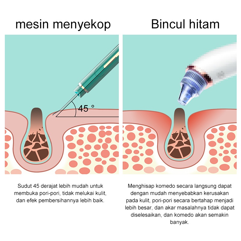 AmazeFan alat pembersih komedo elektrik wajah alat penyedot hidung blackhead remover USG komedo pengangkat jerawat pembersih