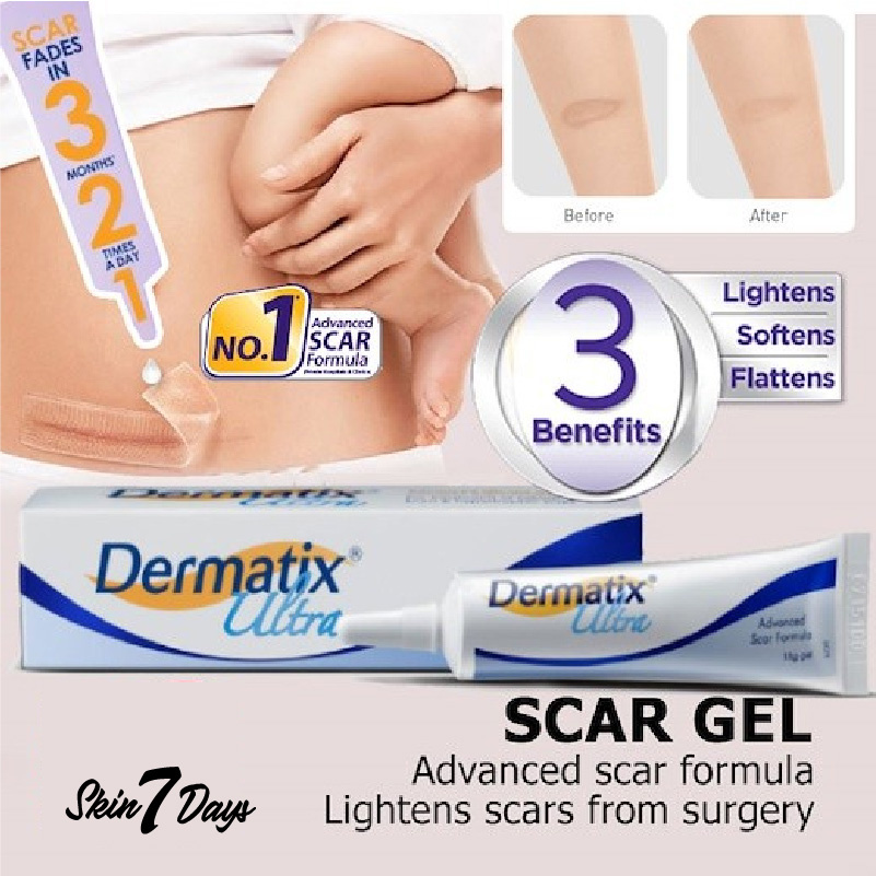 [ Dermatix Ultra ] Cream Penghilang Bekas Luka Operasi Iris Tergores Digigit Serangga Nyamuk / Luka Lama / Bakar / Gatal Hitam Koreng Di Kaki Oprasi Ampuh Advanced Scar Formula Gel Krim Wajah Keloid Stretchmark stretch mark Dermatik Dermatic Usa Original